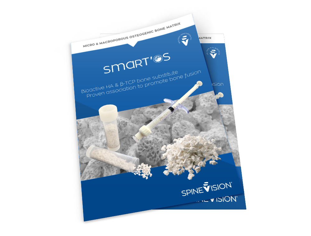 SpineVision_MockupLeaflet_SmartOs