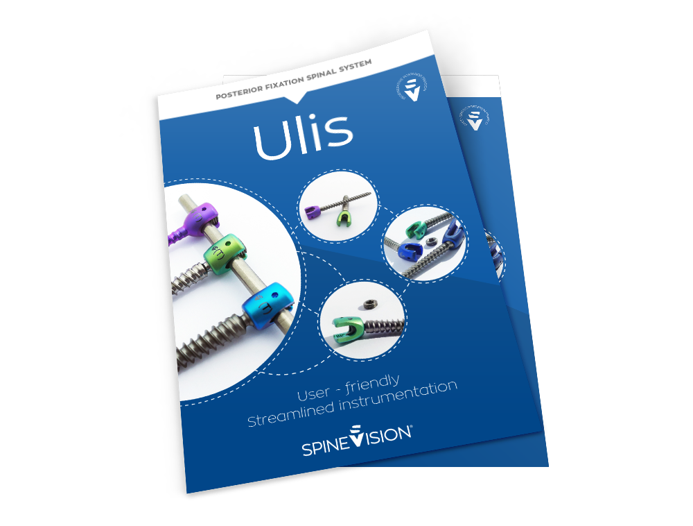ULIS_GB